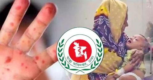 ২৪ ঘণ্টায় হামে আরও ৬ প্রাণহানি, মৃত্যুর সংখ্যা ছাড়াল ৮০০